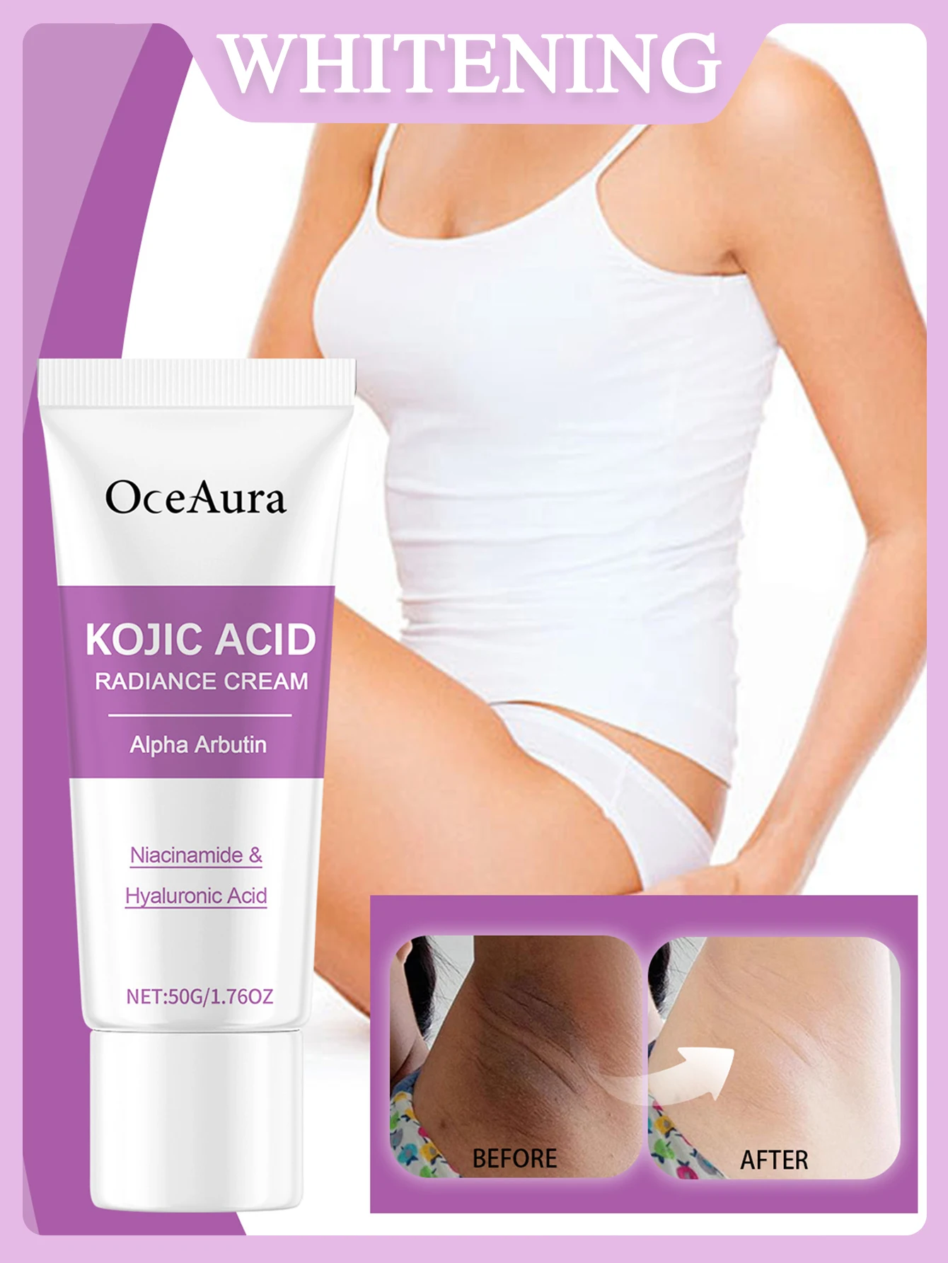 كريم تبييض الجسم 50 جرام، تبييض الأجزاء الخاصة للإناث، العناية المنعشة، الرعاية اليومية، كريم تبييض تحت الإبط