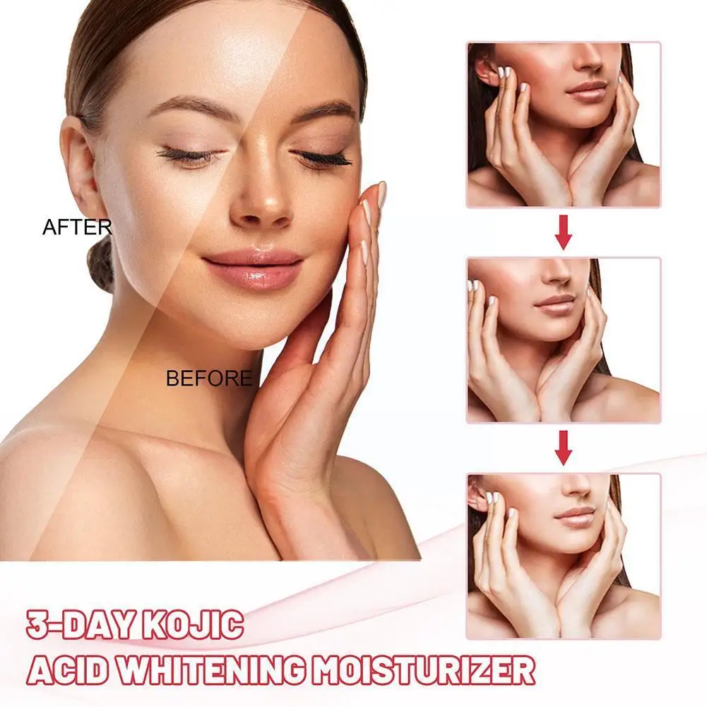 Eelhoe 3 일 코직산 미백 보습 크림, 얼굴 주근깨 다크 크림, 스팟 케어, 브라이트닝 스킨 크림 제거