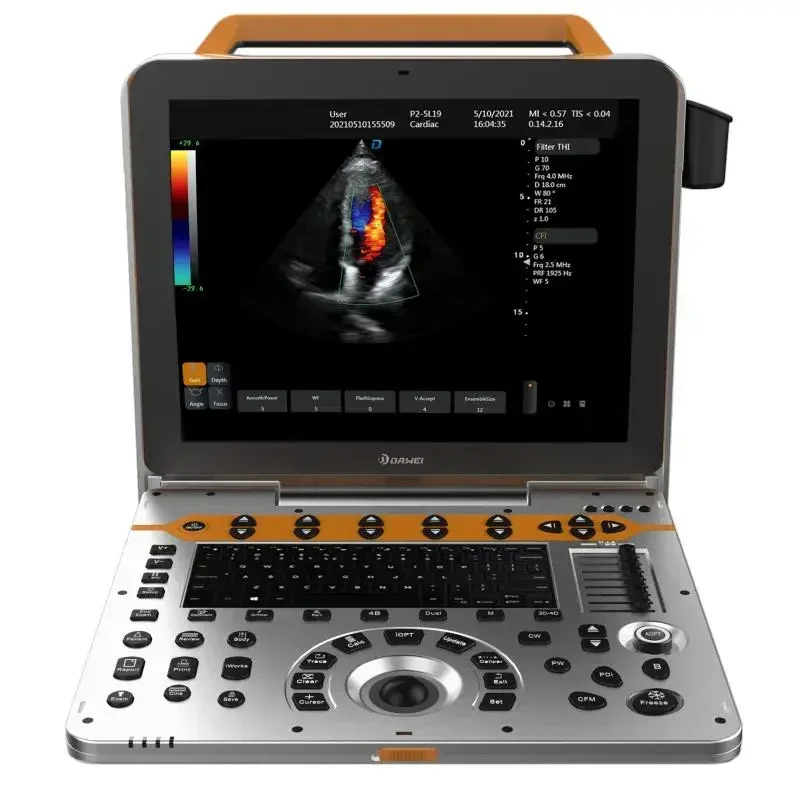 DW-P60 all digital portable 3D 4D  echocardiography color doppler ultrasound machine with suitable price