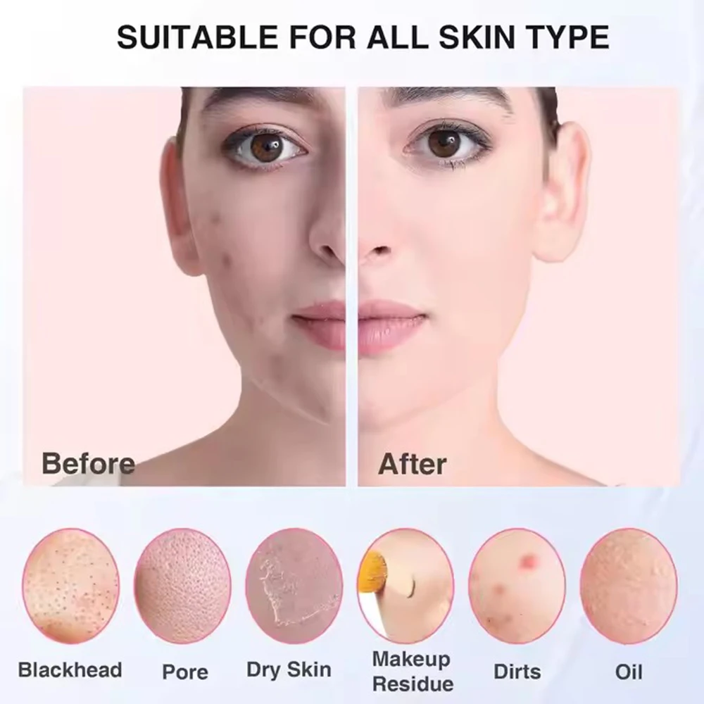 NEW Sonic Waterproof Facial Cleansing Brush for Men & Women Rechargeable Exfoliating Electric Face Scrubber Cleanser Brush