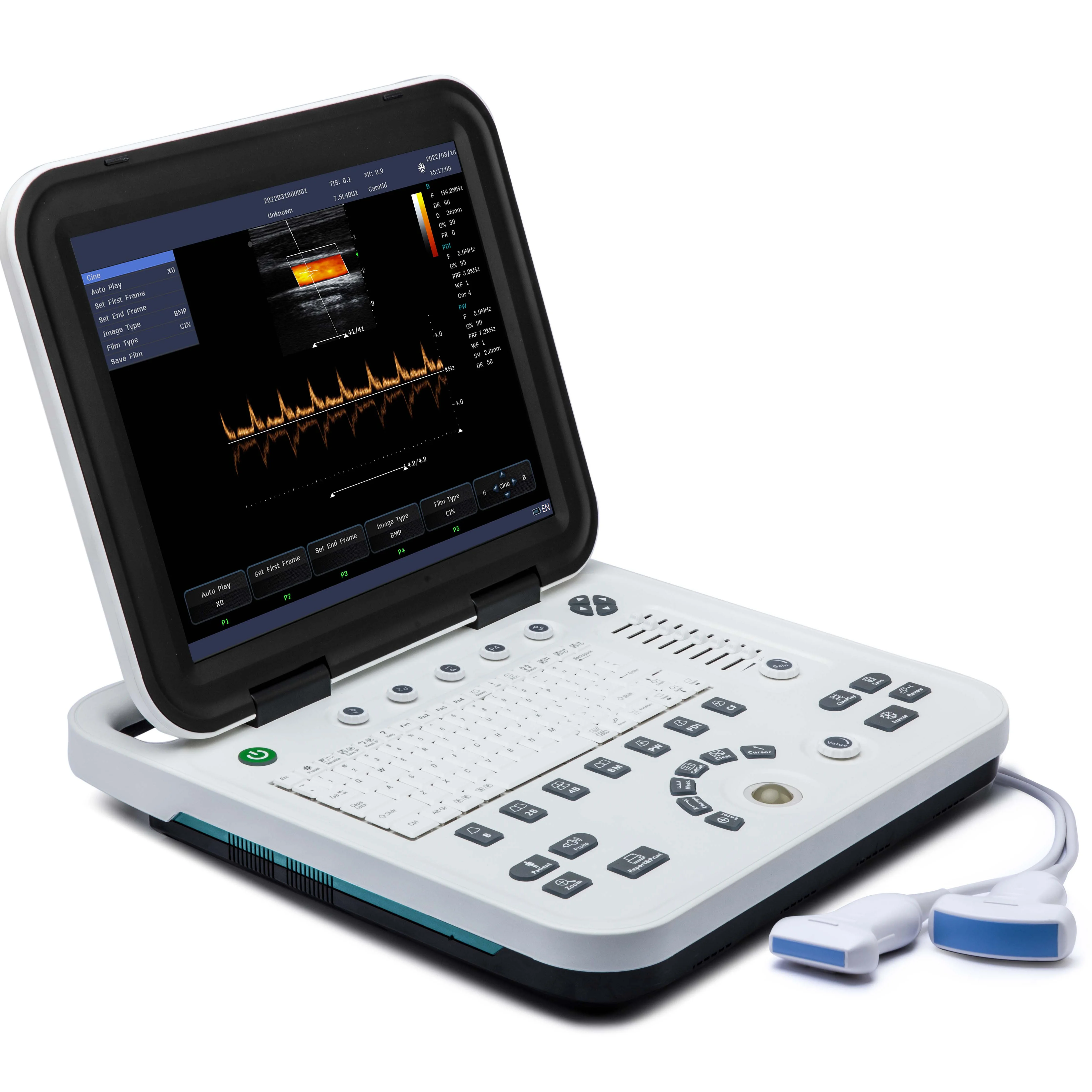 Portable Highly Cost Effective Color Doppler Ultrasound hine for Human