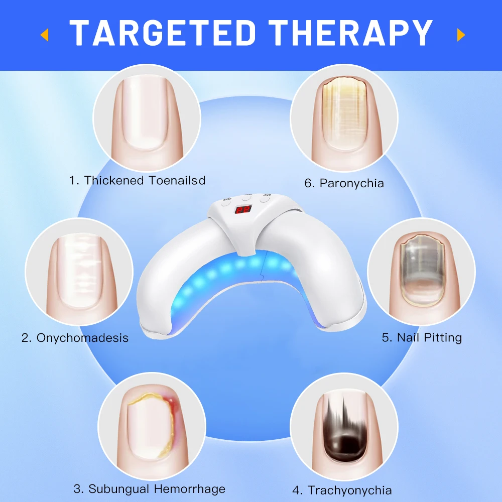 Fungal Nail Laser Device Nails Fast Repair Essence Oil Onychomycosis Toenail Fingernail Removes Foot Care Cure Ingrown