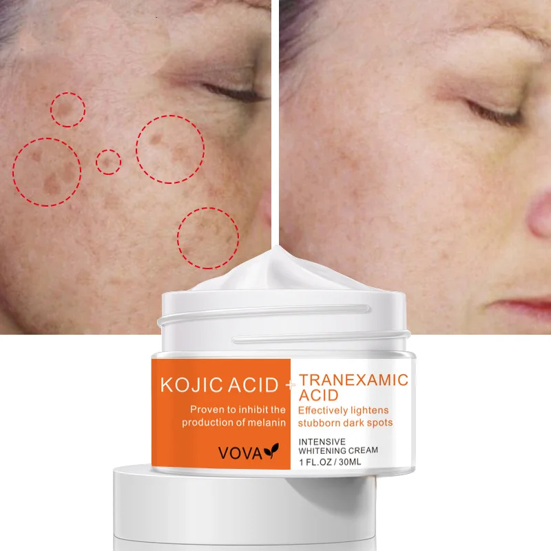 

30ml Kojic Acid Tranexamic Acid Face Whitening Cream Inhibit the Production of Melanin Lightens Stubborn Dark Spots Cream