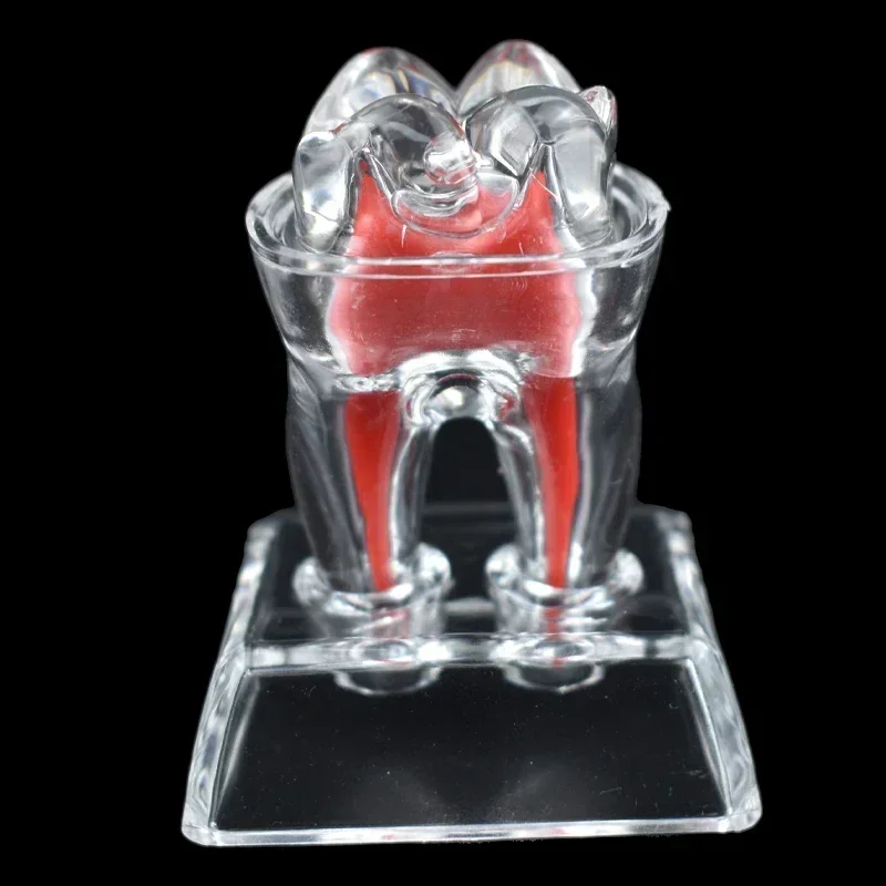 Dental Anatomical Model 4xTeeth Transparent Luminous Detachable Single Tooth Decomposition 70mm Size Dentistry Clinic Ornaments