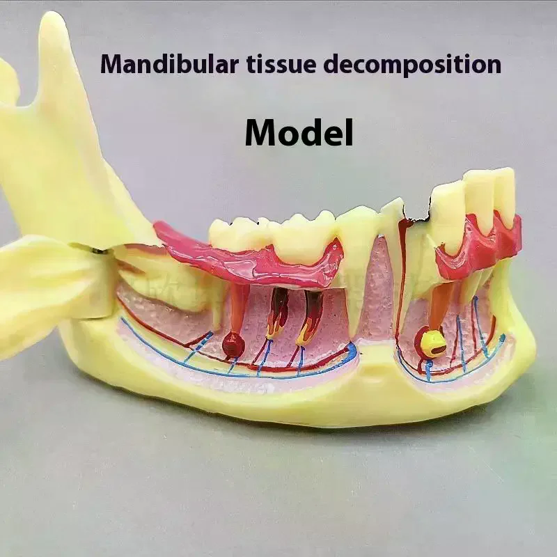 Dental Tool Dental Endodontic  Model Anatomy Gums Mandible Tissue Anatomical Dentist Teach Study Demonstration Teeth