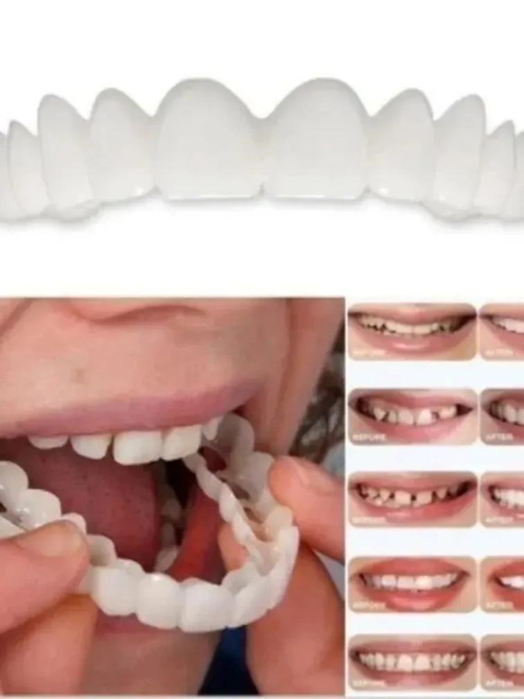 Prothèse dentaire de simulation, ensemble de dents supérieures/infirmières avec boîte, appareil orthodontique, couvre-dents en silicone blanchissant, appareil dentaire