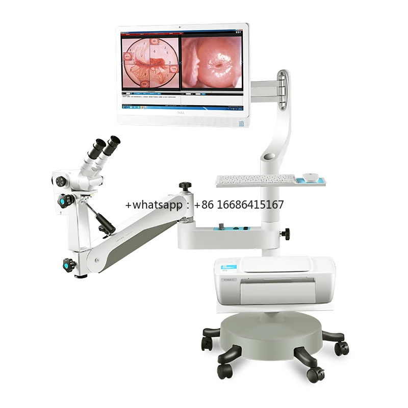 Factory Supply FULL HD 1080P Digital Electronic Binocular For Cervical Cancer Screening