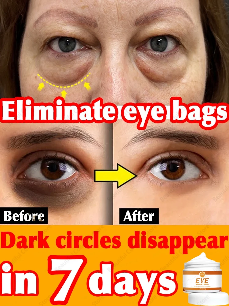 Eye Bags Disappear Care for cream，about 99% of people will repurchase