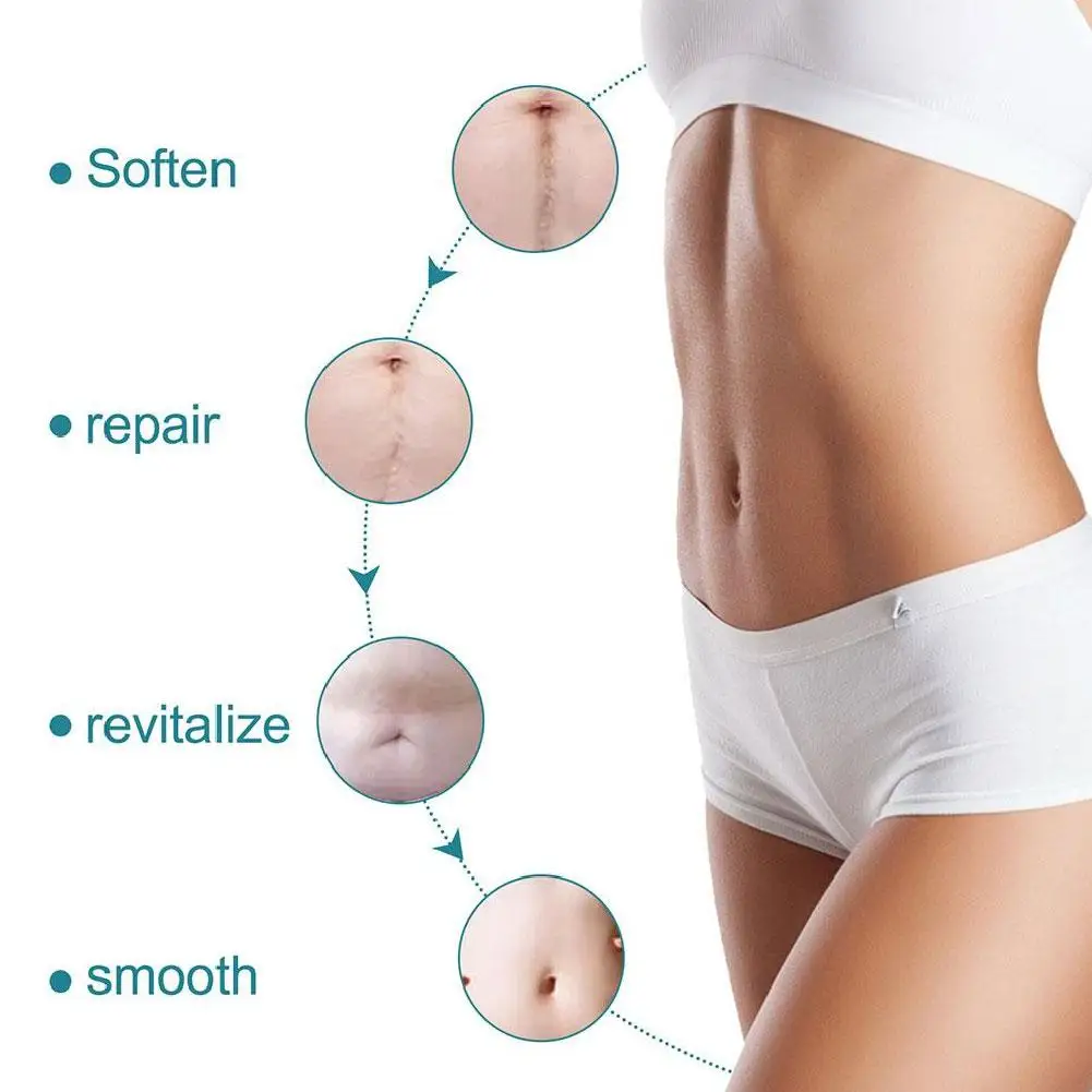 صفائح ندبة من السيليكون، حمالة ندبة من السيليكون لعلاج إزالة الندبات، شرائط ندبة من السيليكون قابلة لإعادة الاستخدام لحرق الجلويد على شكل حرف C #4