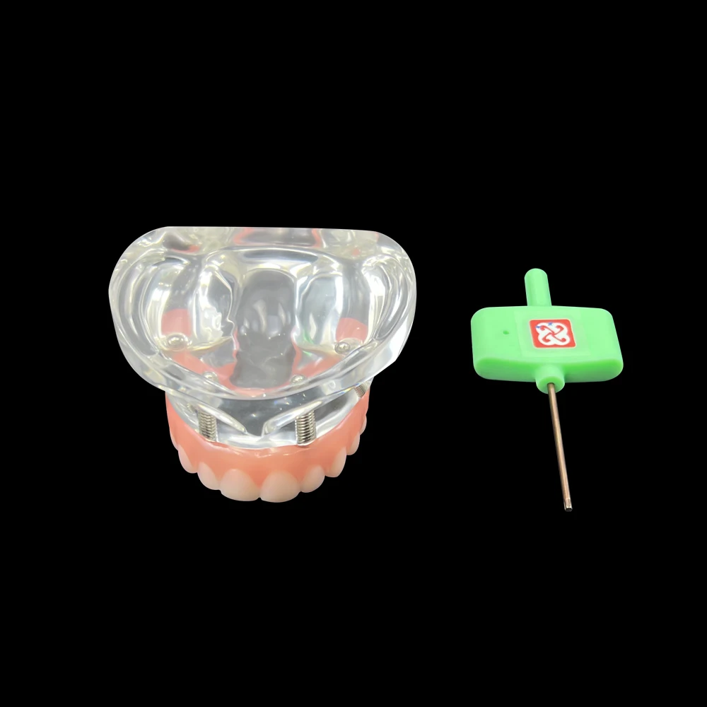 Z implantem Overdenture 4. Wyjmowane śruby. Model górnych zębów. Doskonały model demonstracyjny Typodont. Model do nauki implantów. Model dydaktyczny