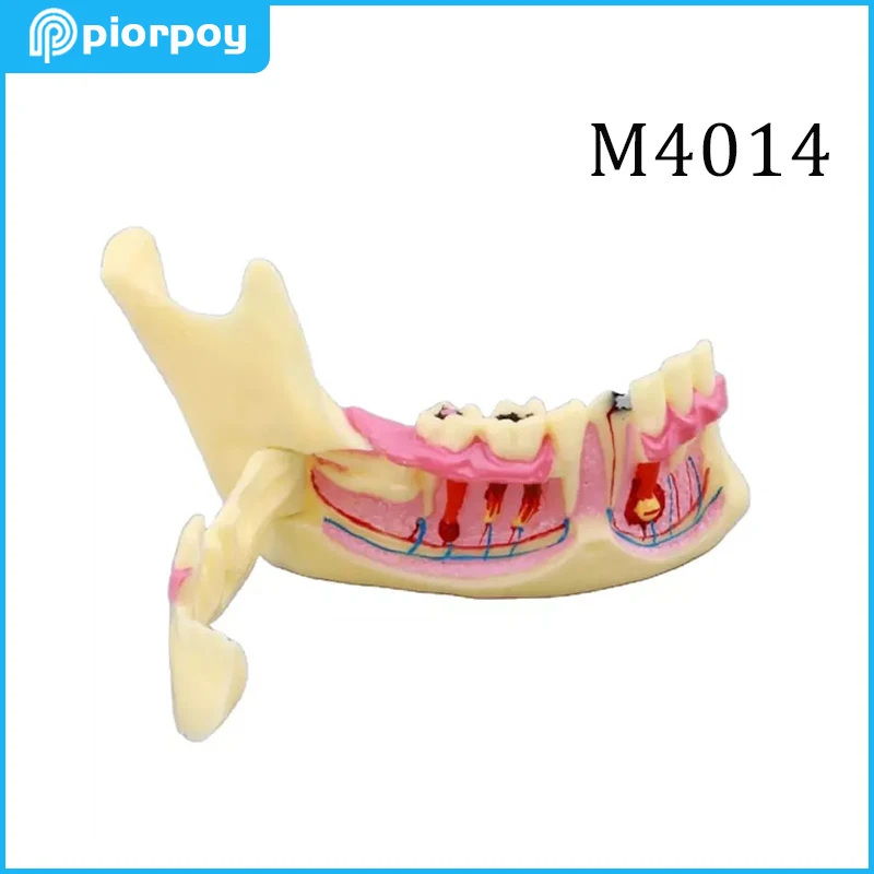 Мстительная стоматологическая обучающая модель, структура зубов, разложение, демонстрация стоматологии, инструменты для обучения студентов M4014