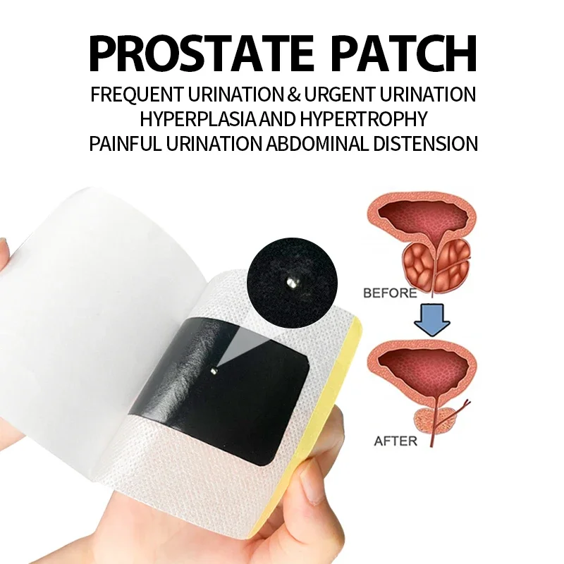 50Pcs Prostate Treatment Patch Prostatic Prostatitis Navel Plaster Urethritis Frequent Urination Urgency Kidney Care Medicine