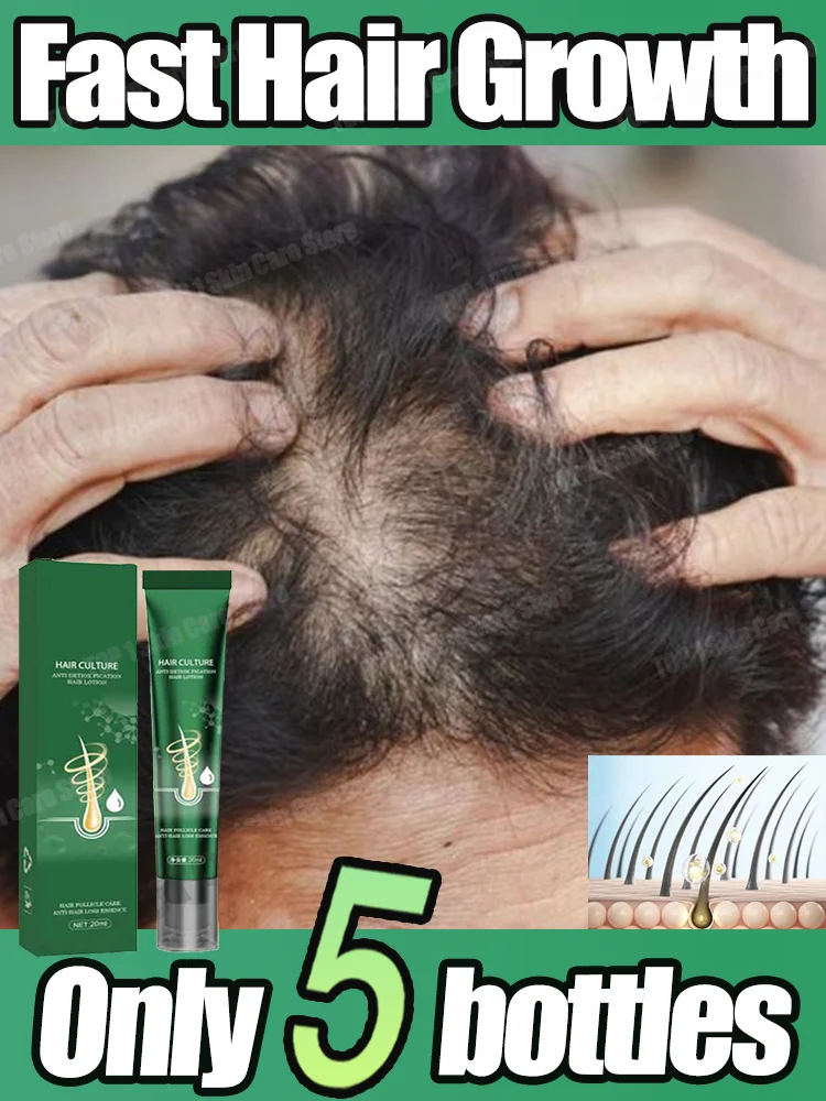 Gran oferta de aceite para el crecimiento del cabello, reparación rápida y efectiva de la calvicie, pérdida de cabello hereditaria posparto, pérdida de cabello seborreica