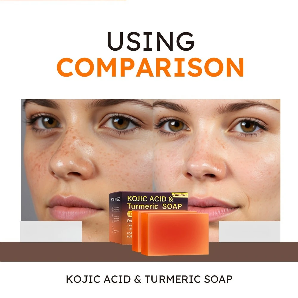 

200 г KOJIC ACID Мило с куркумой Корректор для удаления темных пятен с куркумой помогает удалить темные пятна естественно