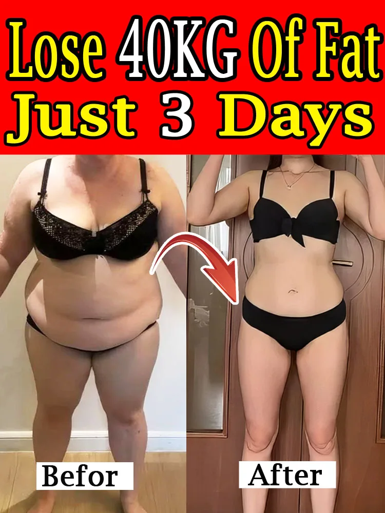 Loss Effective Burn Fat Products Fast for Women Weight Loss Slimming Fat Burning Lose