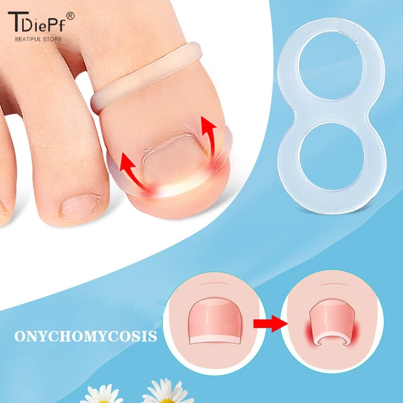 1PCS Silicone Ingrown Toenail Correction Tool Invisible Ingrown Toenail Straightening Protector Brace Pedicure Foot Care Tools