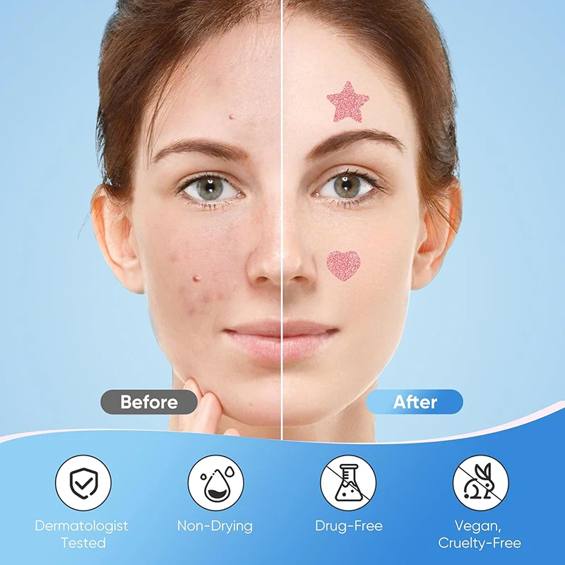 156/276 قطعة لطيف الوردي على شكل قلب بثرة بقع للمراهقين الفتيات إخفاء اندلاع حب الشباب Zit ملصقات أدوات العناية بالوجه #5