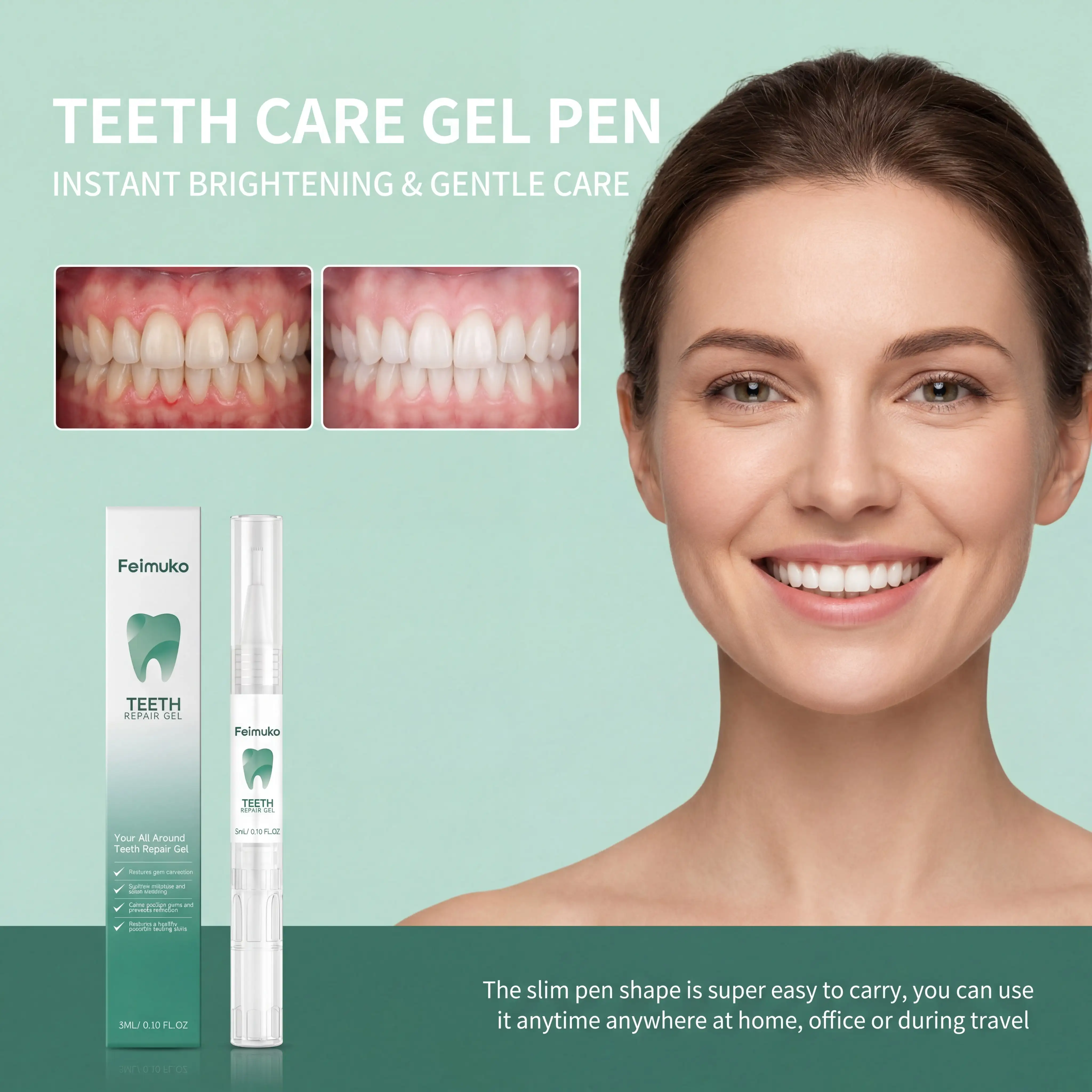 Teeth Whitening Gel Pen - 1/2/3/4/5/8/10 Stuks Milde Tandenverzorging Gel Pen