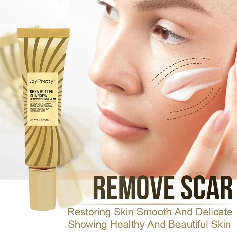 Scar Removal Cream Gel Remove Acne Spots Treatment Stretch Marks Burn Surgical Scar Repair ointment for Whitening Skin Beauty