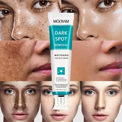 Dark Spot Remover For Face Removal Cream Age Sun Black Spots Freckles Melasma