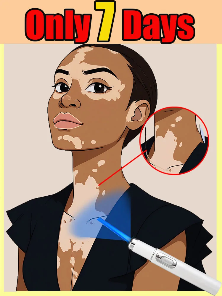 

Blue Light Pen for Effective White Spot Reduction, Provides a Gentle & Comfortable At-Home Care Experience.