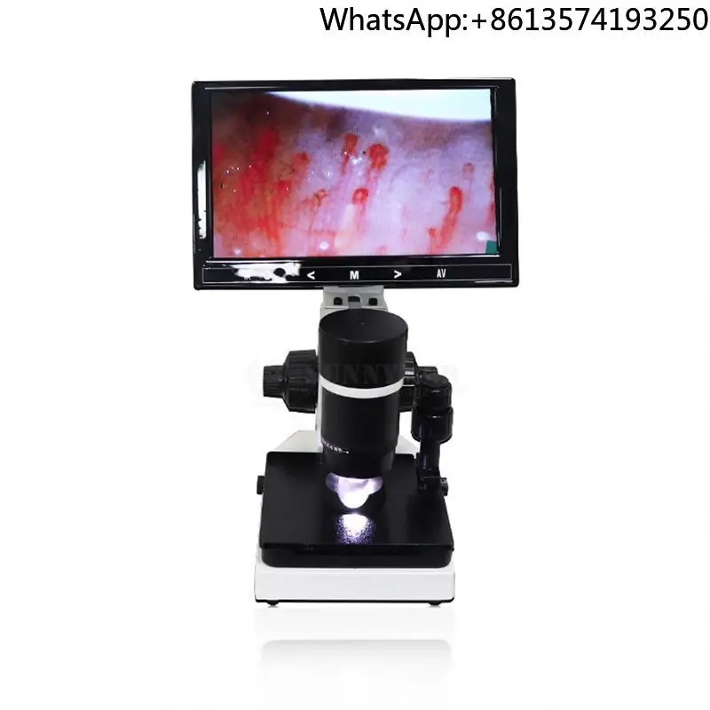 

Capillary Microscope With 9 Inch LCD Screen Nail Fold Capillaroscope Optional materials: stainless steel, plastic