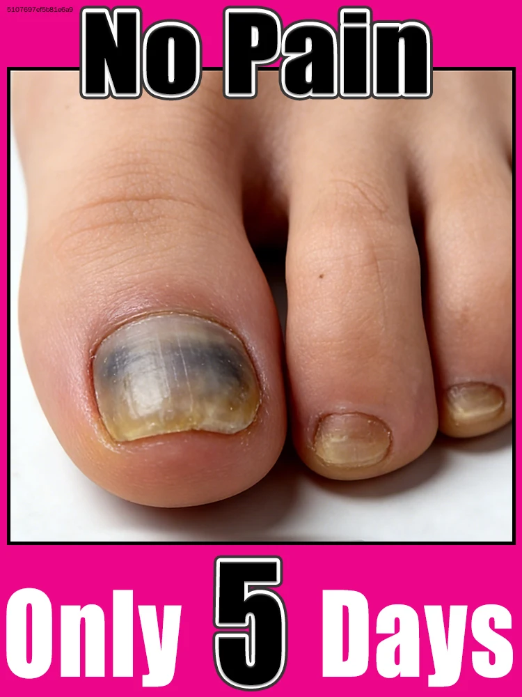 

Vente de vacances, instruments pour ongles, outils de nettoyage des ongles