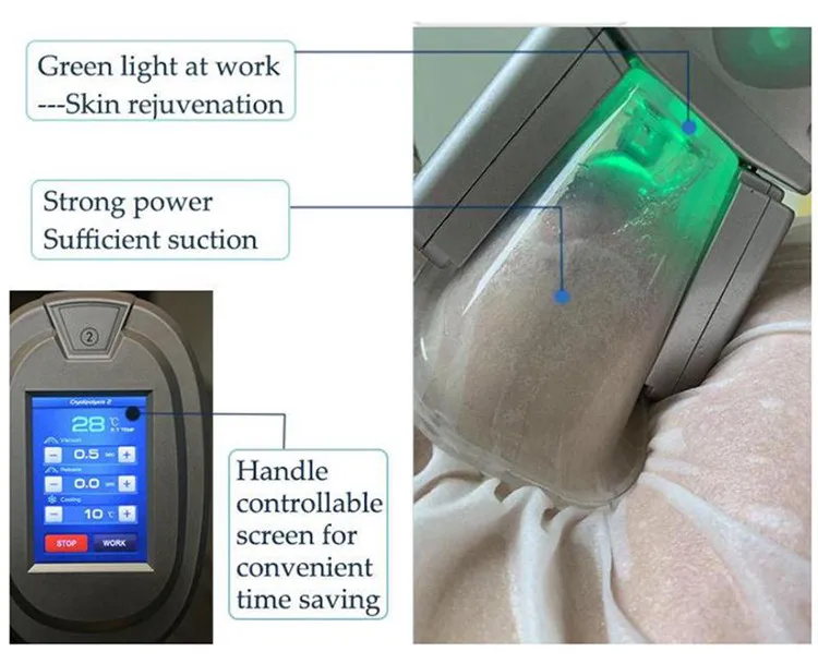 Lipo Vacuum Suction Freeze Fat Heat Light Therapy