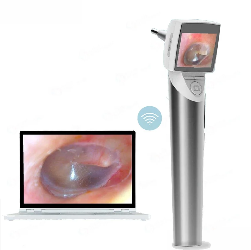 Wireless HD Handheld Digital Video Otoscope Endoscope