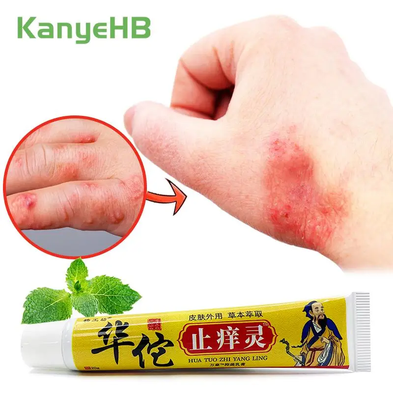 1pcs Anti-itch Anti-fungal Cream Chronic Dermatitis Ointment Cooling Cream For Mosquito Bites Eczema Detumescence Ointment S077