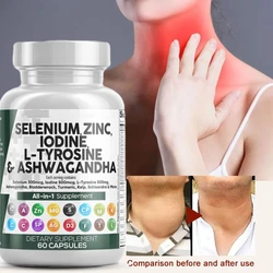 Selenium Essential Mineral Antioxidant Support, Boosts Immune System, Boosts Energy Levels Thyroid Support 60 Veggie Capsules