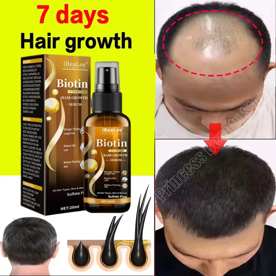 Biotin Hair Growth Serum Anti Hair Loss Products Fast Growing Prevent Dry Frizz Damaged Repair Treatment Scalp Beard Care Spray