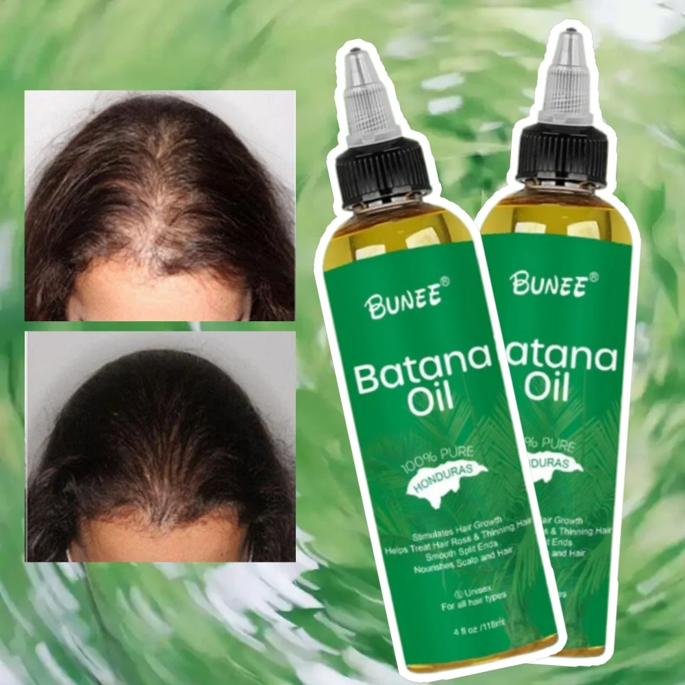 

2 шт., эфирное масло для ухода за волосами Batana, восстанавливающее корни волос, увлажняющее, питательное, укрепляющее, гладкое масло для ухода за волосами