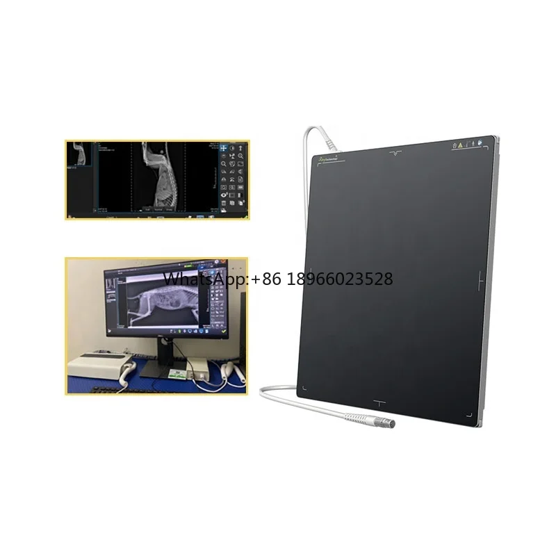 17*17 Wired CSI Flat Panel Veterinary Human DR Digital X Ray rivelatore a schermo piatto