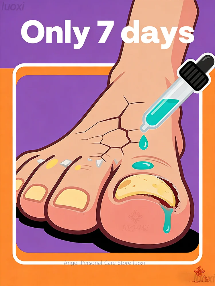 

Нацеливание сухих и грубых ногтей, эфирные масла, проникновение, чтобы увлажнение, почти успокаивает и восстанавливает fragi.