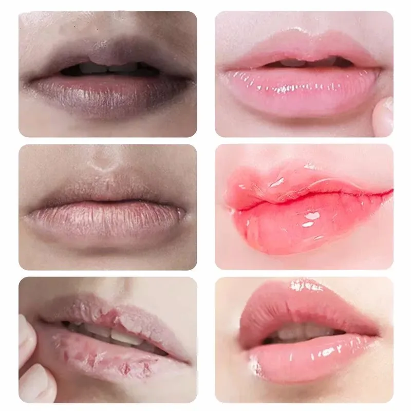 Fast Lightening Pink Mouth Lips Mask Bleaching Permanent Remove Dark Smoke Lips Lip Serum Moisturize Gloss Lipstick Lip Care New