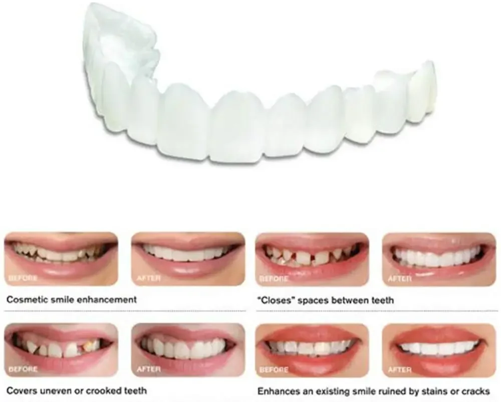 Juego de blanqueamiento dental de ajuste perfecto, cubierta de diente falso, carillas de sonrisa de silicona a presión, herramienta de belleza