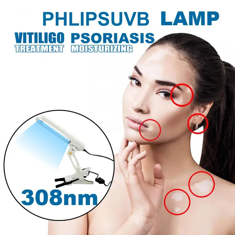 

Handheld 308nm UVB Light Phototherapy for Vitiligo Psoriasis Eczema Skin Problems Treatment Ultraviolet Lamp