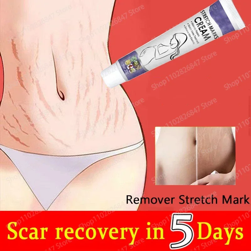 Stretch Mark Removal Cream Postpartum Repair  For Pregnant Women Obesity Mark Growth Marks Thigh Firming Skin Scar Removal Serum