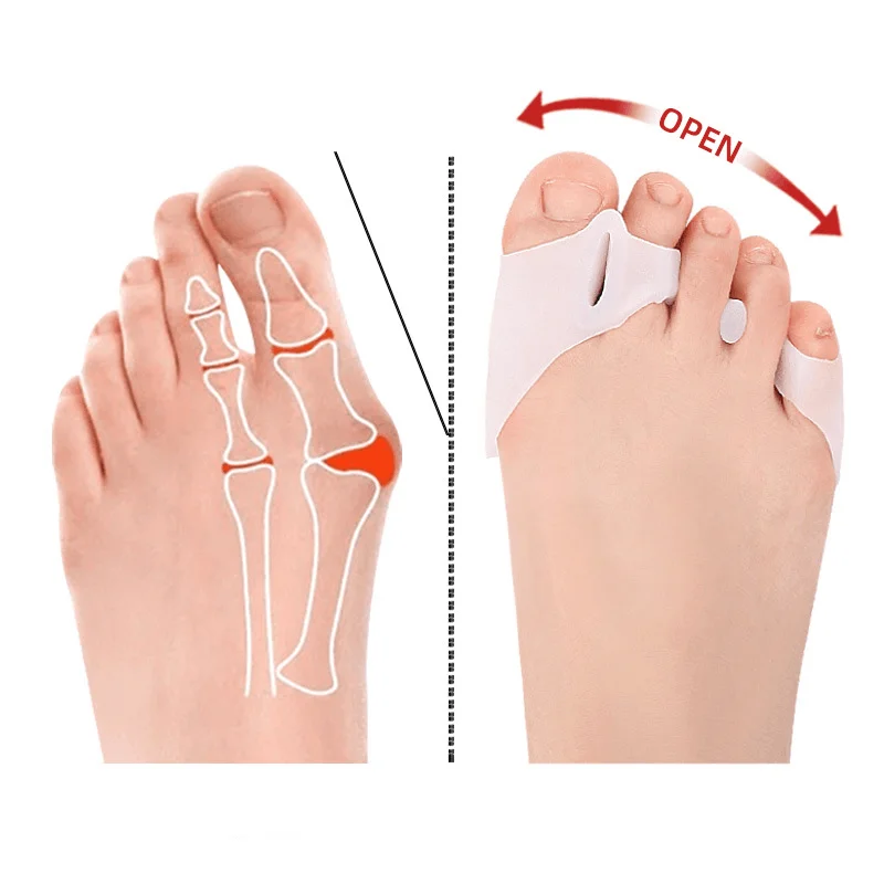 1/2/5Pairs Silicone Toe Separator Hallux Valgus Corrector Bunion Orthotics Protector Pain Relief Forefoot Pad Socks Foot Care