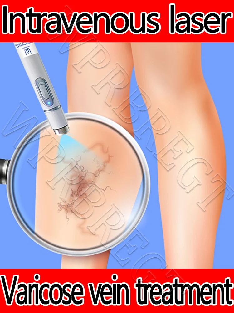 

Relieving Spider Leg Pain: Laser Pointer Therapy