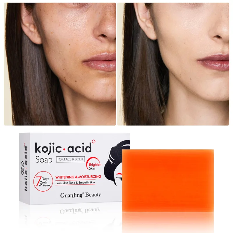 Kojic Acid Retinol Cream Skin Whitening Cream Anti Aging Brighten Fade Stubborn Dark Spots Moisturiz Nourish Facial Skin Care