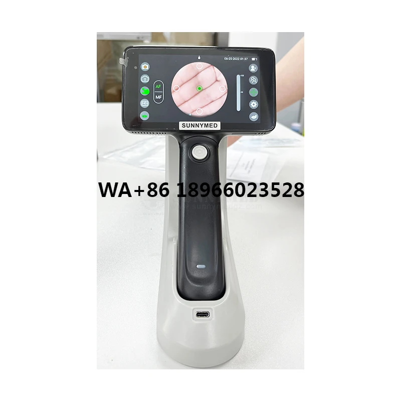 SY-V042 Portable fundus camera with touch screen  Digital Eye fundus camera