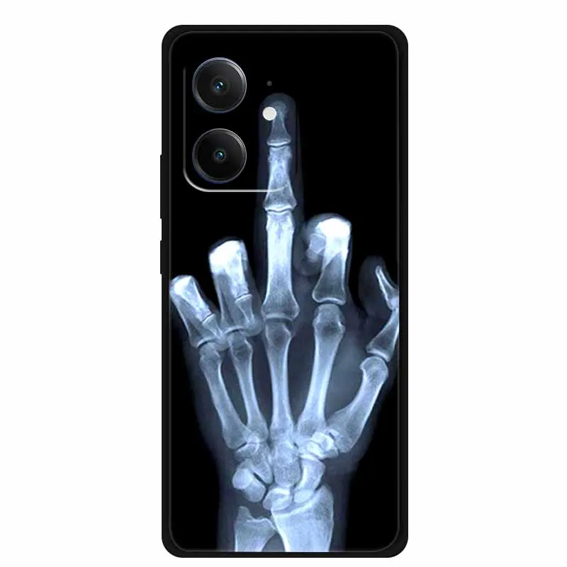 الغطاء الخلفي ل Realme Neo7 SE Neo7x Neo7 حافظة Neo 7x7SE أسود سيليكون لينة حافظة هاتف من البولي يوريثان ل Realme C65 4G غطاء كوكه فوندا