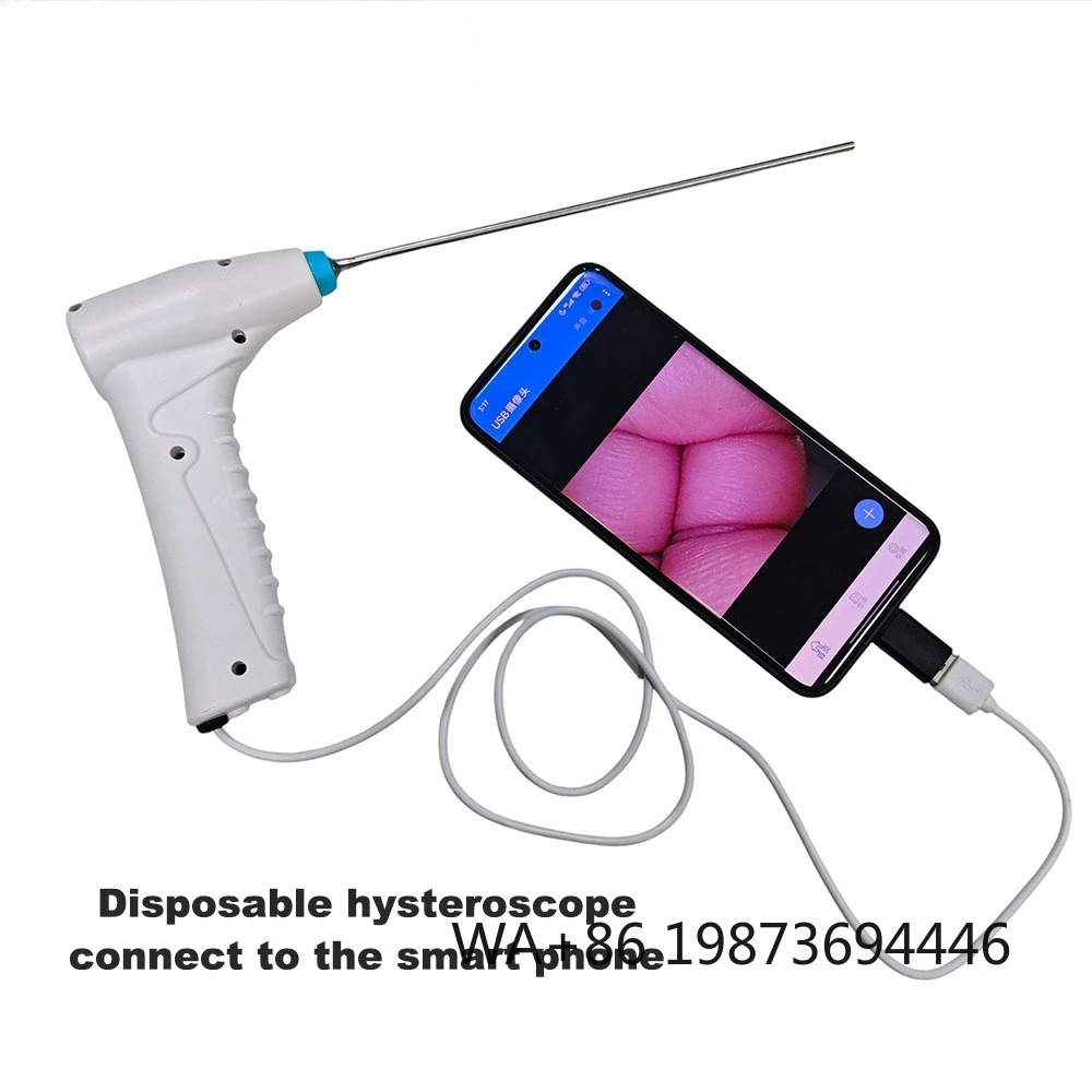 Portable Disposable Hysteroscope Compatible with Laptop & Android Devices for Clinical Clinic Examination
