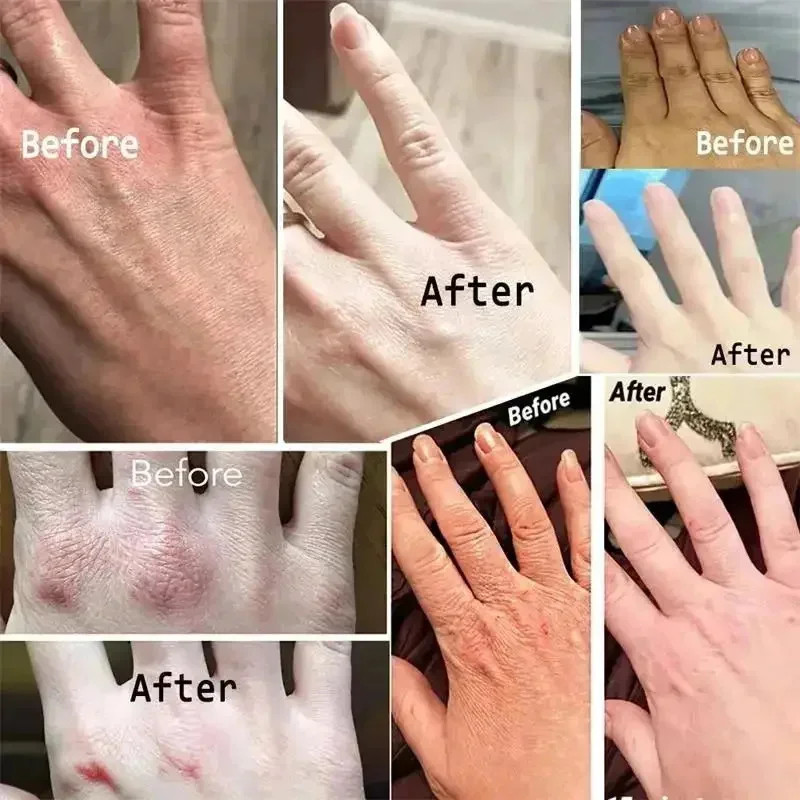 Crema per le mani antirughe riparazione piedi mani Anti-essiccazione Anti-crack pelle nutriente cura esfoliante sbiancare idratante prodotto di bellezza