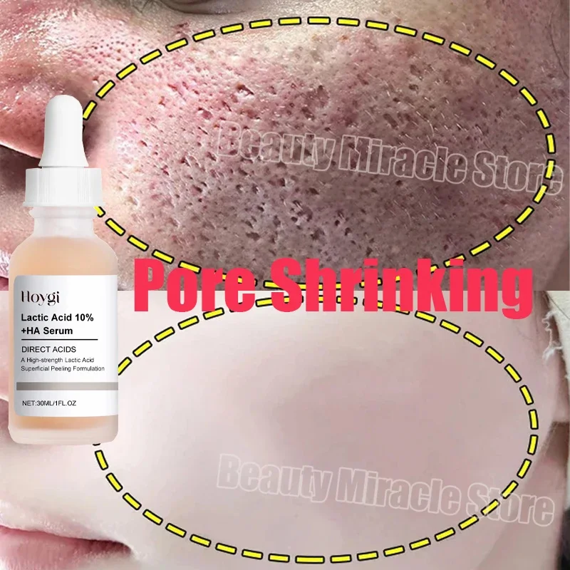 Remove Large Pores Serum Lactic Acid Facial Pore Shrinking Repairing Products Pore Minimizing Firming Smooth Korean Skin Care