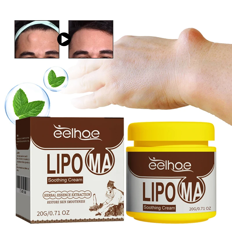 Subcutaneous Lumps Remove Soothing Cream Skin Swelling Cellulite Fibroma Fat Mass Plaster Treatment Medicine Liquid Products