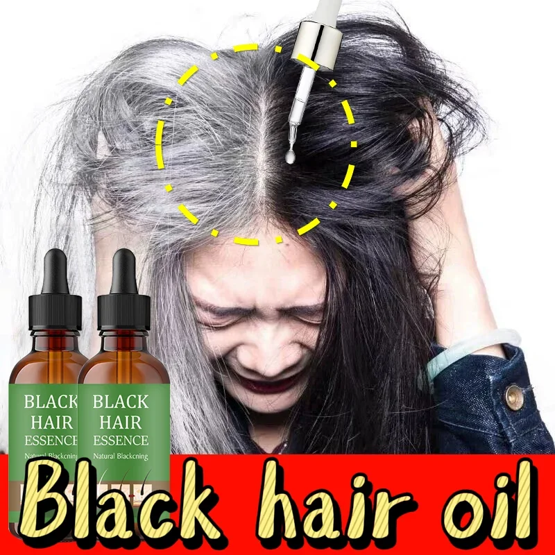 White Hair Removal anti-white hair black artifact oil drops Black growth from the source, anti-white ahair growth liquid12