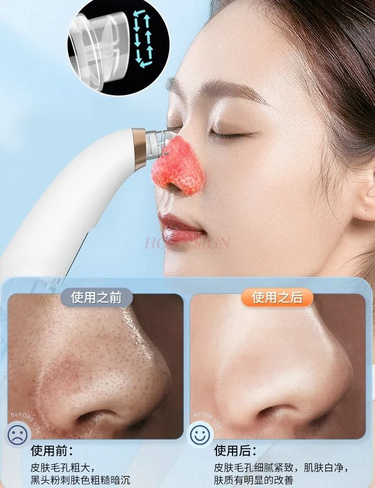 Visual blackhead aspirator, acne removal pore cleaner, electric small bubble blackhead aspirator